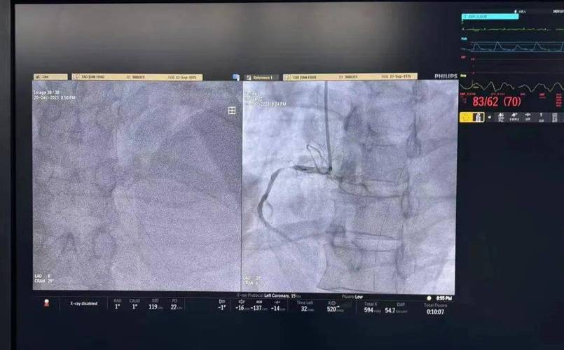 今日特码科普！心脏骤停1小时获救,百科词条爱好_2024最快更新