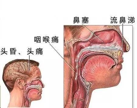 今日特码科普！流感不是普通重感冒,百科词条爱好_2024最快更新